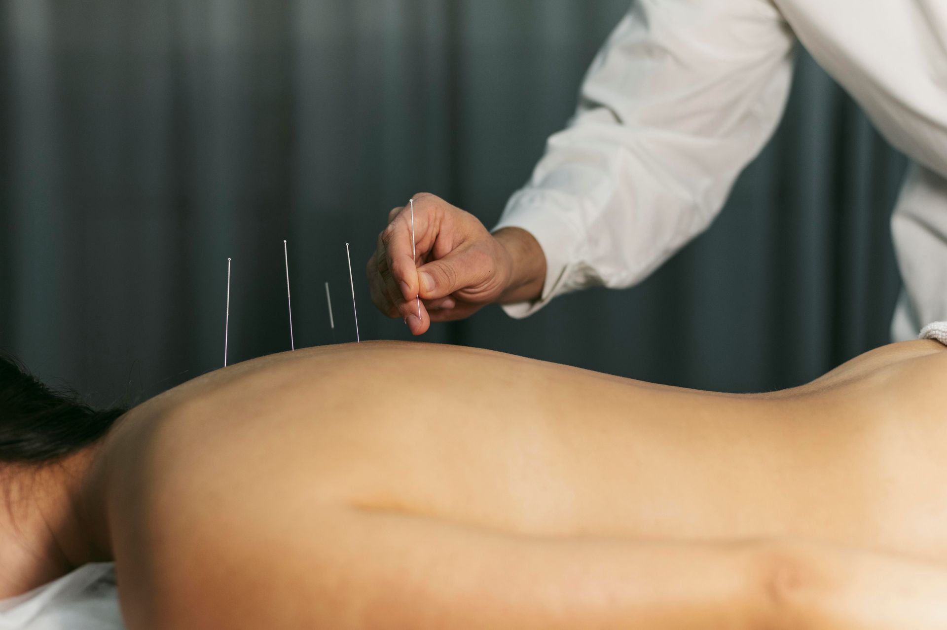 Acupuncture : Pourquoi, pour qui ?