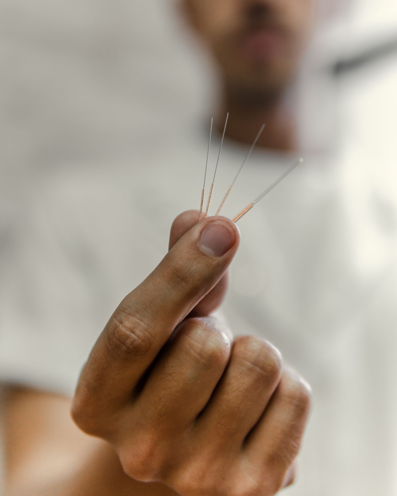 Acupuncture avec aiguilles standards