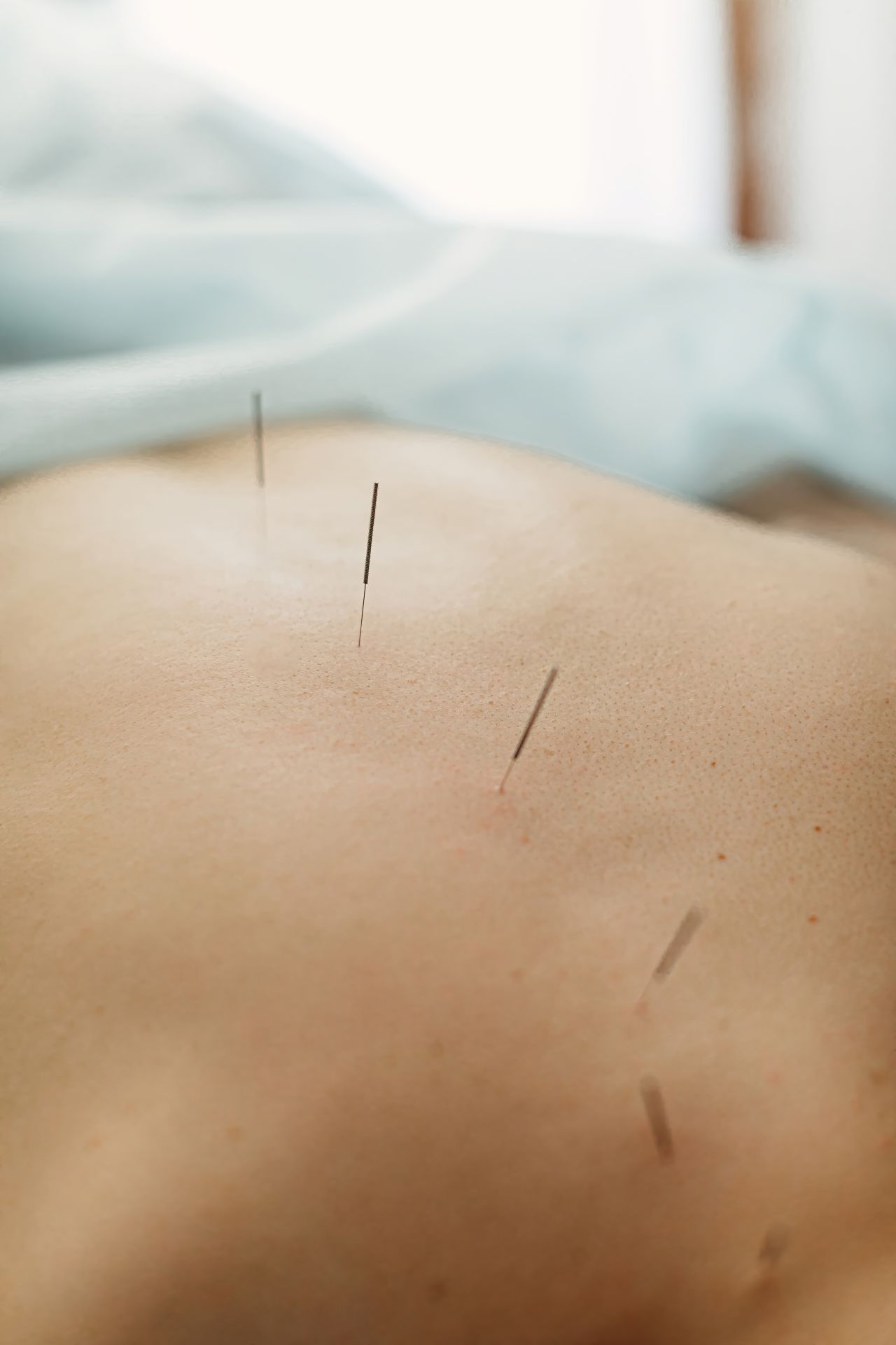AFC en Acupuncture et Médecine Traditionnelle Chinoise