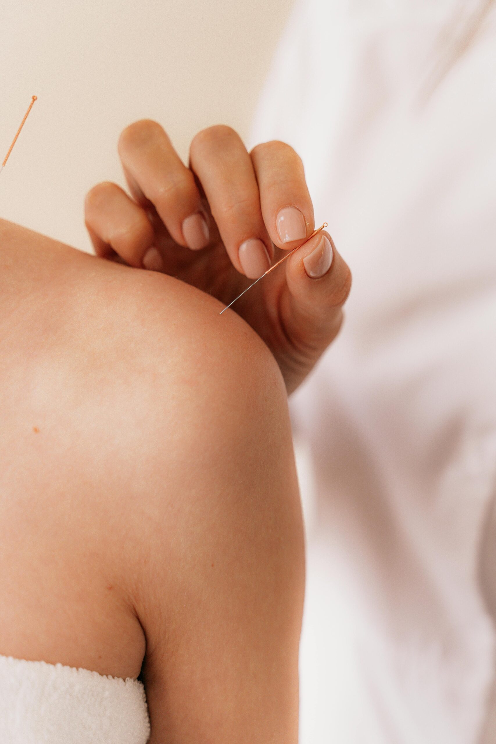 Electro-acupuncture